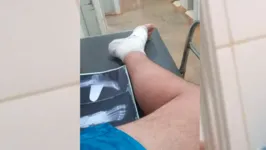 Trabalhador teve o pé direito perfurado pela lâmina