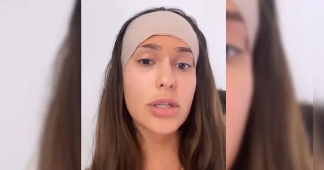 Imagem ilustrativa da notícia A ex-BBB Thais Braz tira 2 cm da testa em cirurgia; veja
