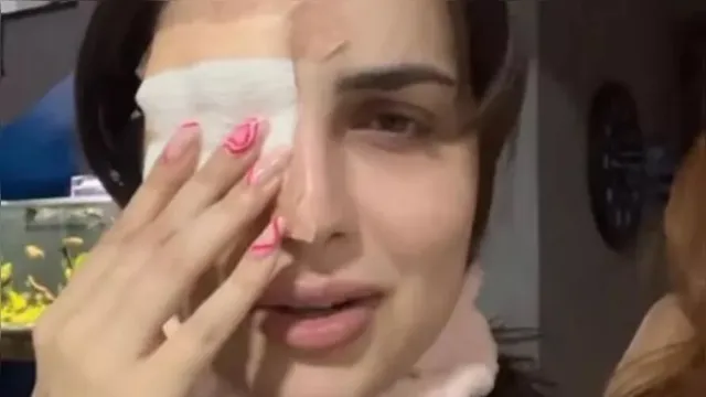Imagem ilustrativa da notícia Influencer corta córnea ao coçar olho com unhas grandes