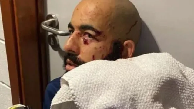 Imagem ilustrativa da notícia Goleiro fala sobre cirurgia no olho e quer rápido retorno