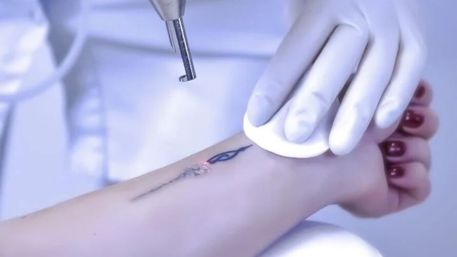 A nova tecnologia é baseada em um sistema de tatuagens eletrônicas que serão aplicadas na pele.