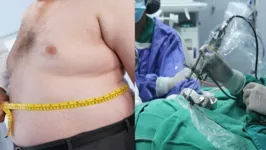 Primeiro passo é reconhecer o momento que a cirurgia é necessária