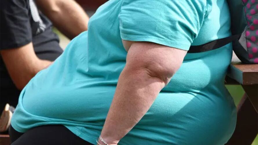 Os beneficiários com obesidade grave ou mórbida são 0,84% do total, ou seja, 84 em cada 10 mil.