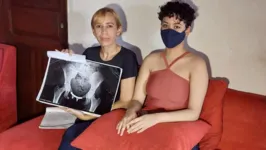 Cirurgia é esperança para que gastos reduzam e Jully tenha melhoras