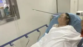 Mulher é atingida no rosto por flecha de 70 cm na China