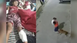 Imagem ilustrativa da notícia Vídeo: Pit-bull ataca menino de 9 anos no RJ