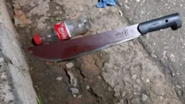 A mulher perdeu 10 mm da calota craniana após ser atacada com facão pelo ex-marido