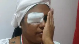 Vivian ficou cega após ser agredida por vizinho