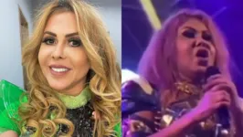 Joelma foi internada para tratar de inchaço no rosto.