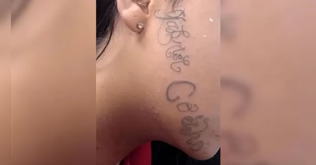 Imagem ilustrativa da notícia Jovem desaparece e volta com nome do ex tatuado no rosto