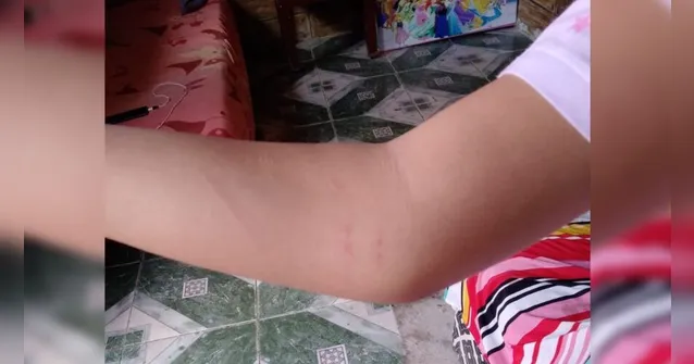 Imagem ilustrativa da notícia Aluna com Síndrome de Down é agredida em escola de Marituba