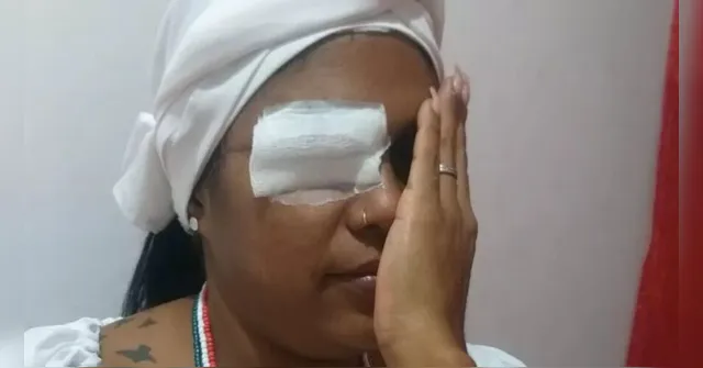 Imagem ilustrativa da notícia Mulher toma facada no olho por ouvir "música de macumba"