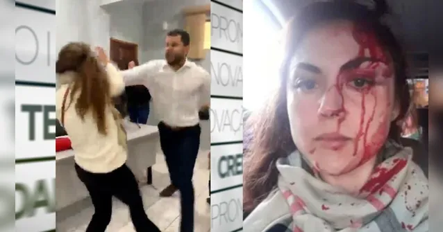 Imagem ilustrativa da notícia Vídeo: procuradora é agredida a socos por colega de trabalho