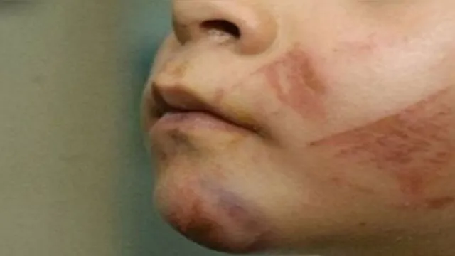 Imagem ilustrativa da notícia SP: mulher agride filha de 4 anos e acaba sendo espancada