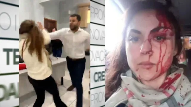 Imagem ilustrativa da notícia Vídeo: procuradora é agredida a socos por colega de trabalho