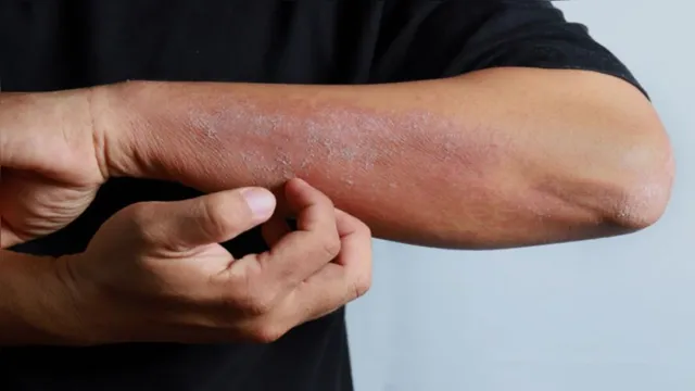 Imagem ilustrativa da notícia Conheça 6 sinais na pele que podem indicar diabetes