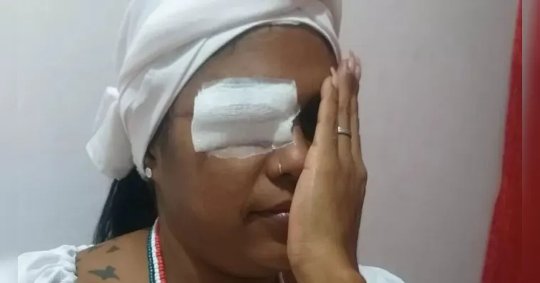 Imagem ilustrativa da notícia Mulher toma facada no olho por ouvir "música de macumba"