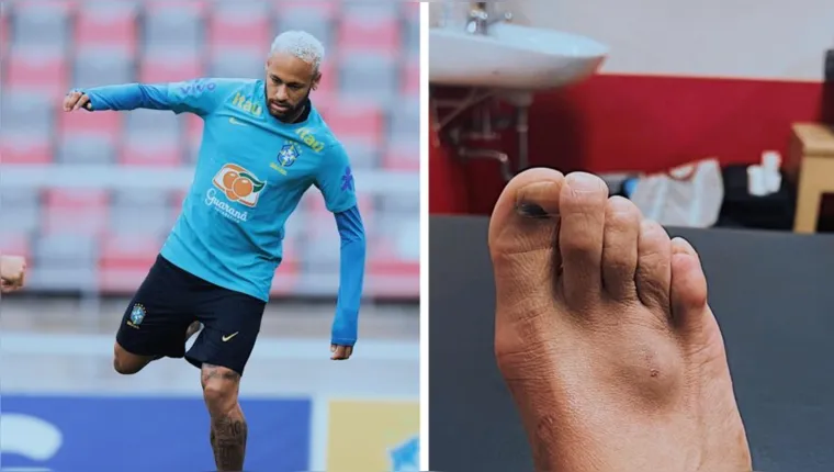 Imagem ilustrativa da notícia Neymar se machuca novamente e pode ficar fora da seleção