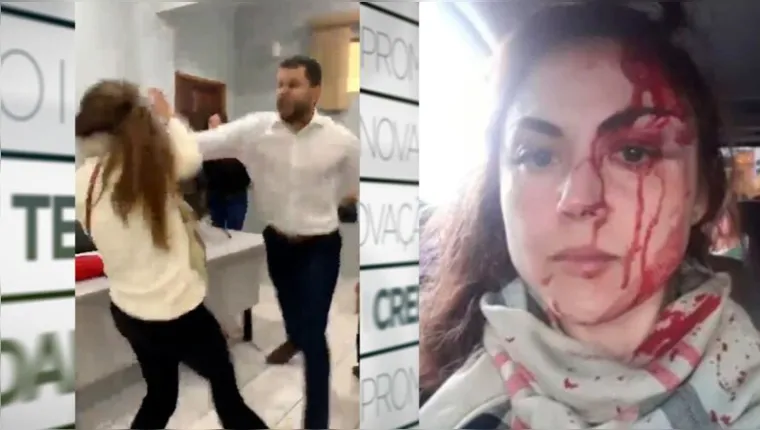 Imagem ilustrativa da notícia Vídeo: procuradora é agredida a socos por colega de trabalho