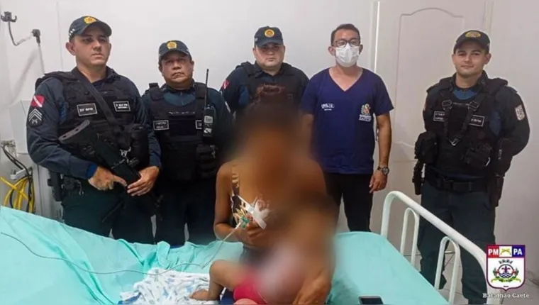 Imagem ilustrativa da notícia Bebê cai em fogareiro no Pará e é salvo por policiais