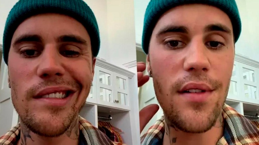 Justin Bieber compartilhou um vídeo nas redes sociais para explicar a síndrome rara que está afetando a sua saúde