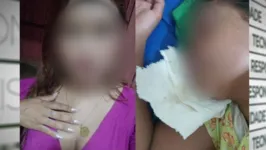 A vítima, que não tem parentes na região, segue internada em estado de coma.