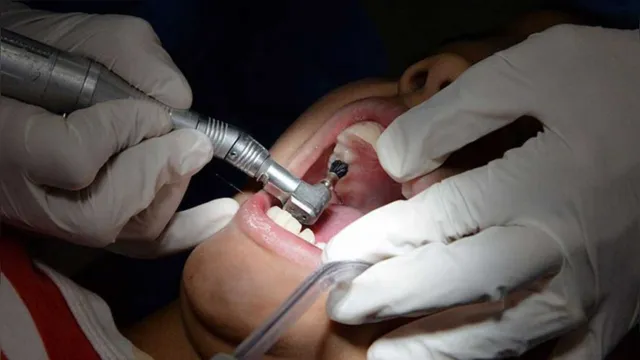 Imagem ilustrativa da notícia Ferida e dente torto podem indicar tumor na boca da criança