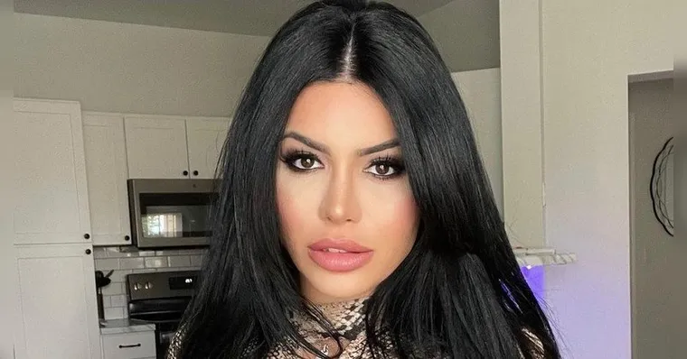 Imagem ilustrativa da notícia Influencer desabafa ao ficar sem umbigo após plástica. Veja!