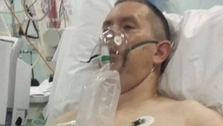 Imagem ilustrativa da notícia Homem tem costelas perfuradas após ataque de arraia