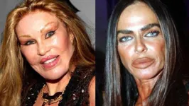 Jocelyn Wildenstein e Michaela Romanini após inúmeras cirurgias plásticas