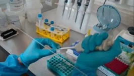 O Instituto Evandro Chagas (IEC) é referência para diagnóstico laboratorial de Monkeypox na Região Norte.