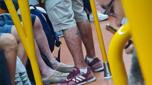 Imagem ilustrativa da notícia Infectado com varíola do macaco é flagrado no metrô de Madri