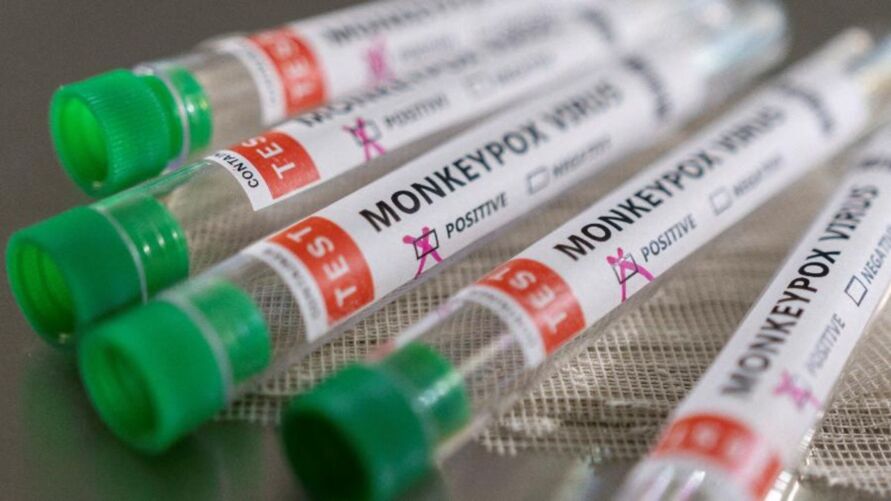 Vacina contra varíola dos macacos está sendo negociada, segundo o Ministério da Saúde.