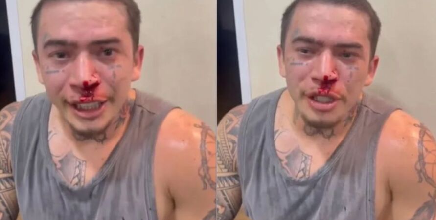 Imagem ilustrativa da notícia: Whindersson Nunes, apanha, sangra no rosto e mostra o Buda
