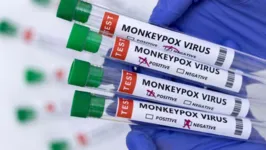A notificação de casos de varíola dos macacos passa a ser compulsória no Brasil.