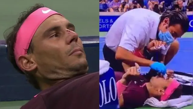 Imagem ilustrativa da notícia Vídeo: Rafael Nadal toma "raquetada" no rosto em torneio 