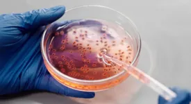 A cólera é uma doença bacteriana infecciosa intestinal aguda, transmitida por contaminação fecal-oral.