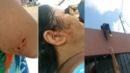 Uma das vítimas ficou com ferimentos no rosto, nas braço e no pescoço foi encaminhada para uma UPA.