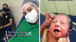 Mãe e bebê que nasceu com dois dentes