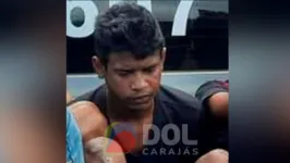 Diego Cabral Araújo, conhecido como "Índio", de 24 anos está em estado grave no hospital