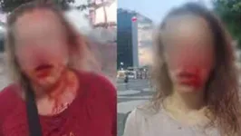 Katarina, 43, e Viktoria, 21, são turistas da Eslováquia e caminhavam pela orla quando foram abordadas por dois adolescentes.