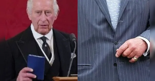 Imagem ilustrativa da notícia Mãos inchadas de Charles III viram meme na web; entenda!