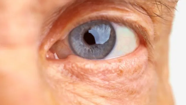 Imagem ilustrativa da notícia Doença ocular relacionada à idade pode levar à cegueira