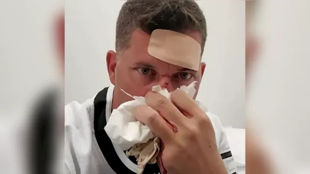 Imagem ilustrativa da notícia Torcedor quebra nariz após tomar "discada" em jogo de hóquei
