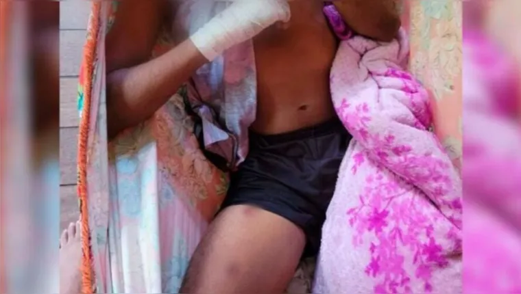 Imagem ilustrativa da notícia Vídeo: adolescente é atacado por onça no Marajó