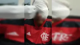 Jovem após a cirurgia