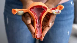 O câncer do colo do útero, em sua forma mais grave, acomete 49 a cada 100 mil mulheres no Brasil.