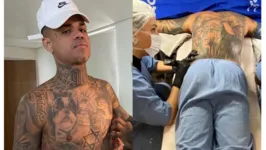 Imagem ilustrativa da notícia Cabelinho toma anestesia geral para terminar tatuagem