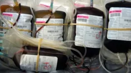 As autoridades de saúde afirmam que não existe risco pelo uso de sangue de doadores vacinados em cirurgias.