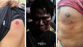 Indígenas feridos em confronto com segurança privados de empresas de dendê
